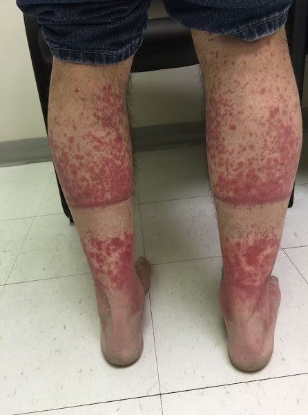 These are the consequences of sleeping with