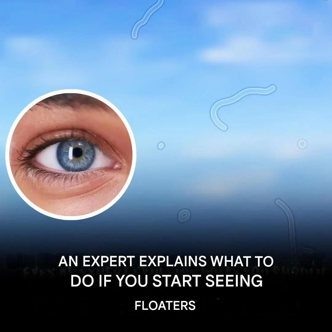 Those filaments in your vision: when should you worry? A specialist answers