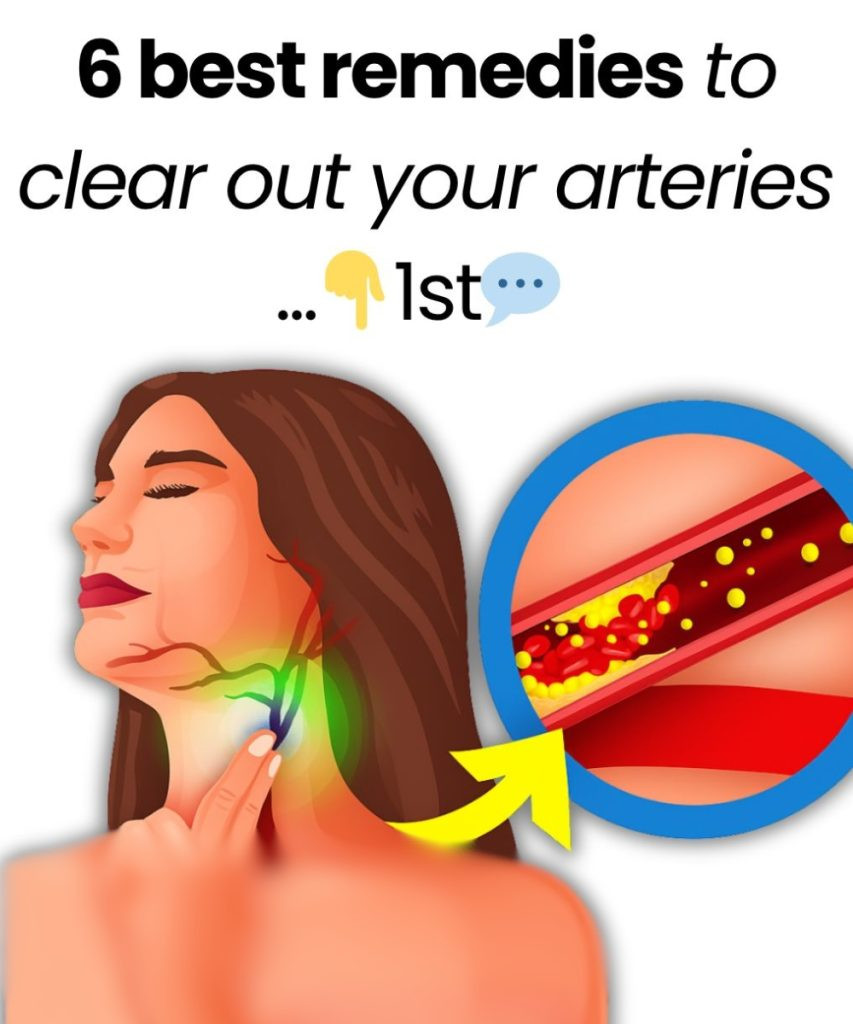 6 Best Remedies To Clear Out Your Arteries