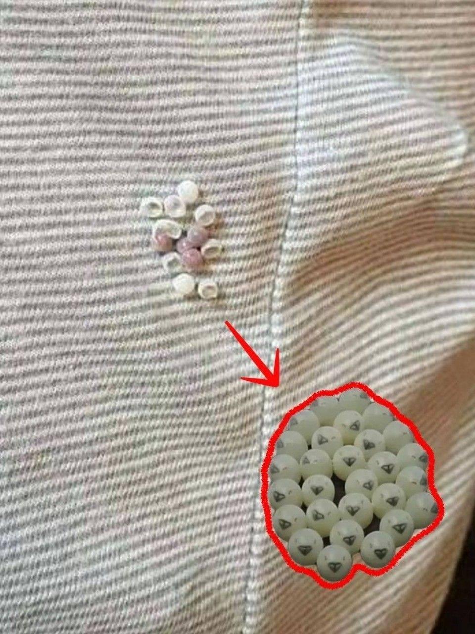 Search Results for: I found these tiny balls in my bed and nearly had a heart att.ack: here’s what they were