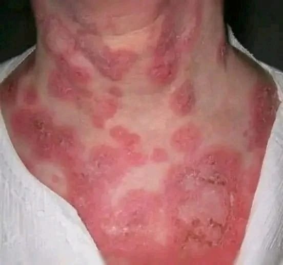 These are the consequences of sleeping with…See more