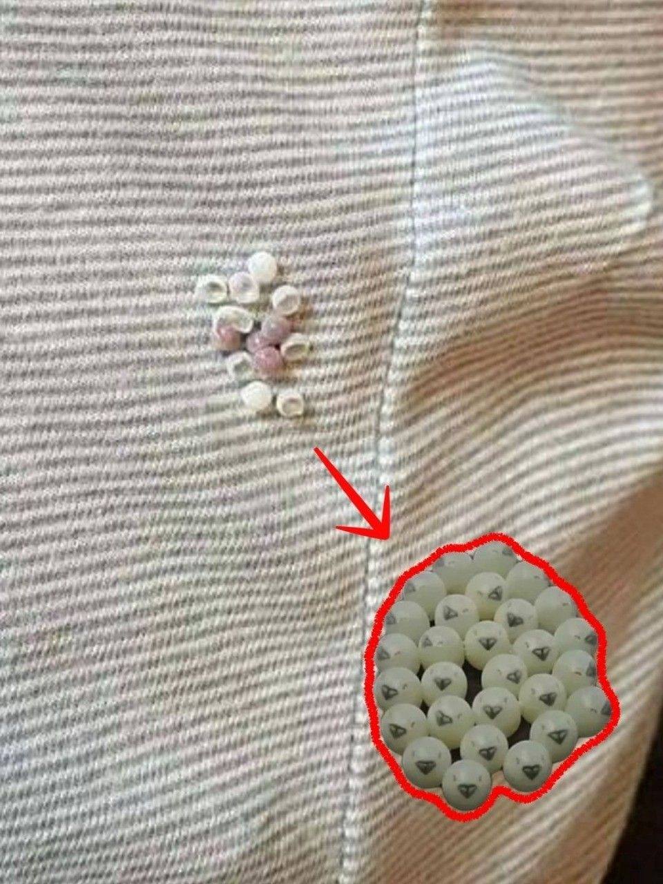 Search Results for: I found these tiny balls in my bed and nearly had a heart att.ack: here’s what they were