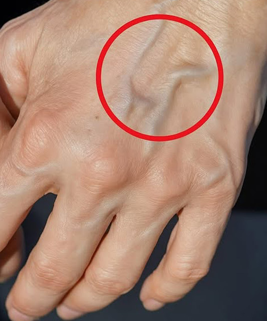 If you have visible veins, it means you are…