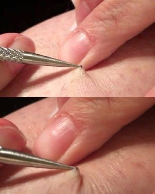 A Man Notices a Dark Spot on His Leg — What He Later Learned Surprised Many People