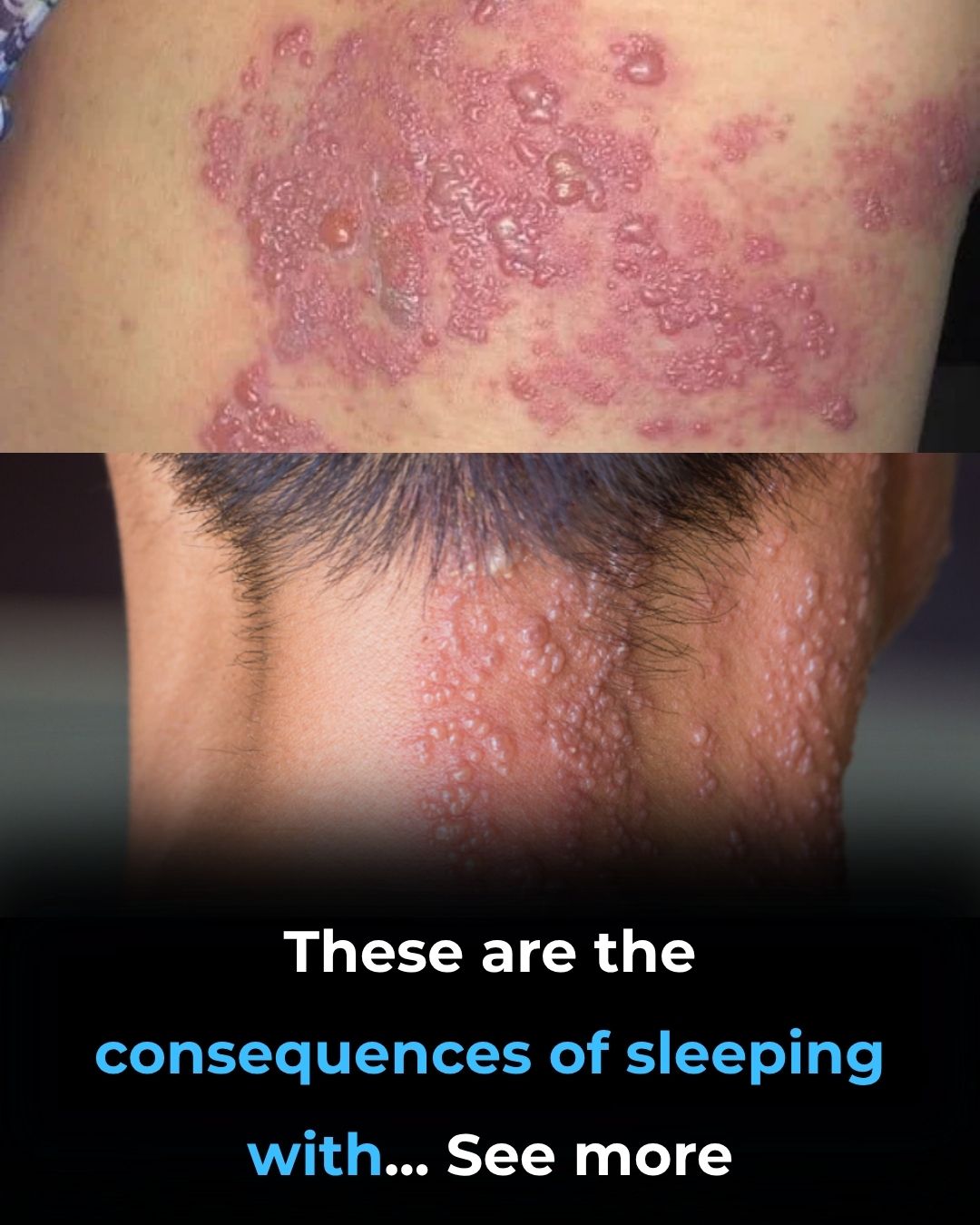 These are the consequences of sleeping with the…