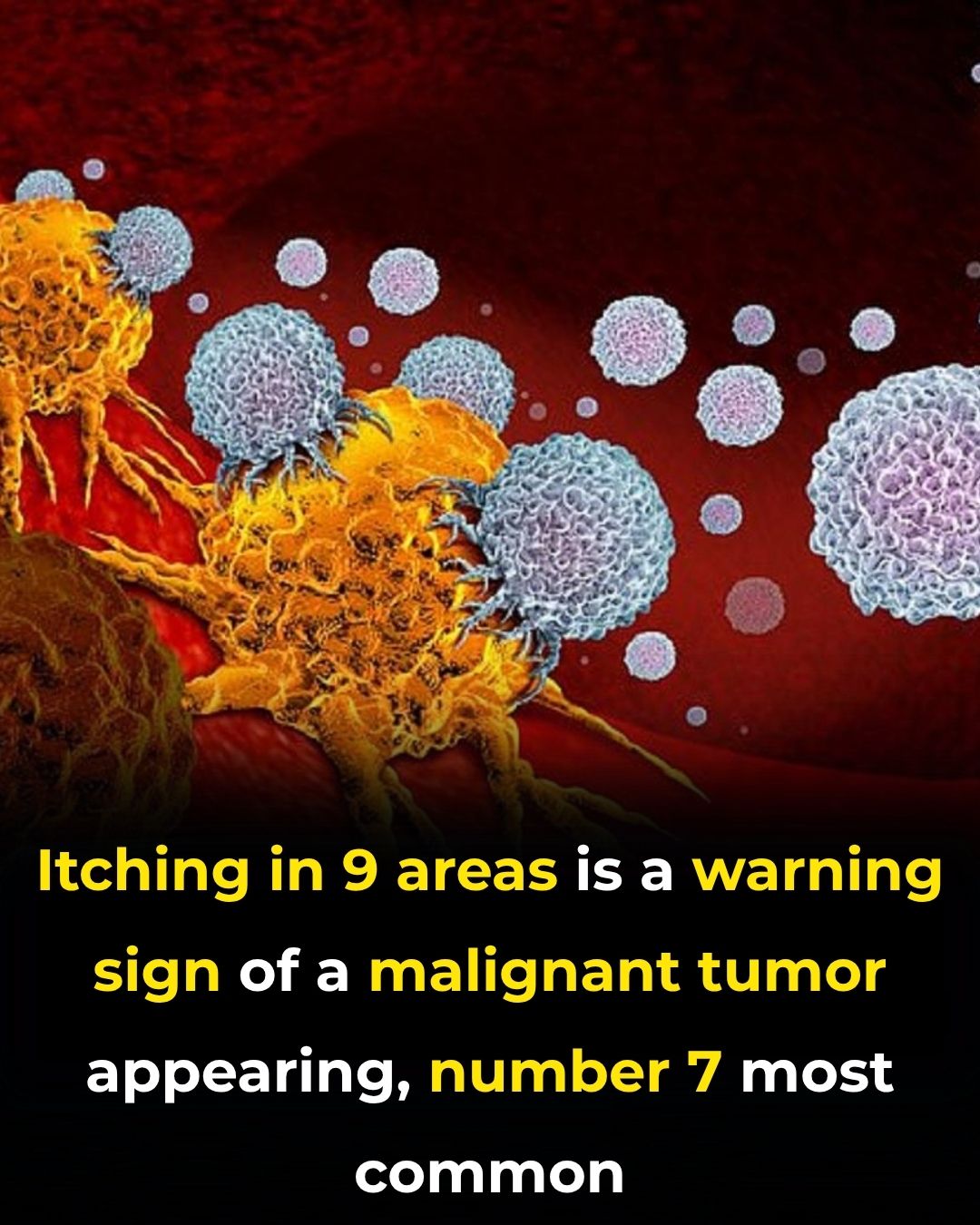 Itching in 9 Areas: A Warning Sign of Malignant Tumors, Number 7 Is the Most Common
