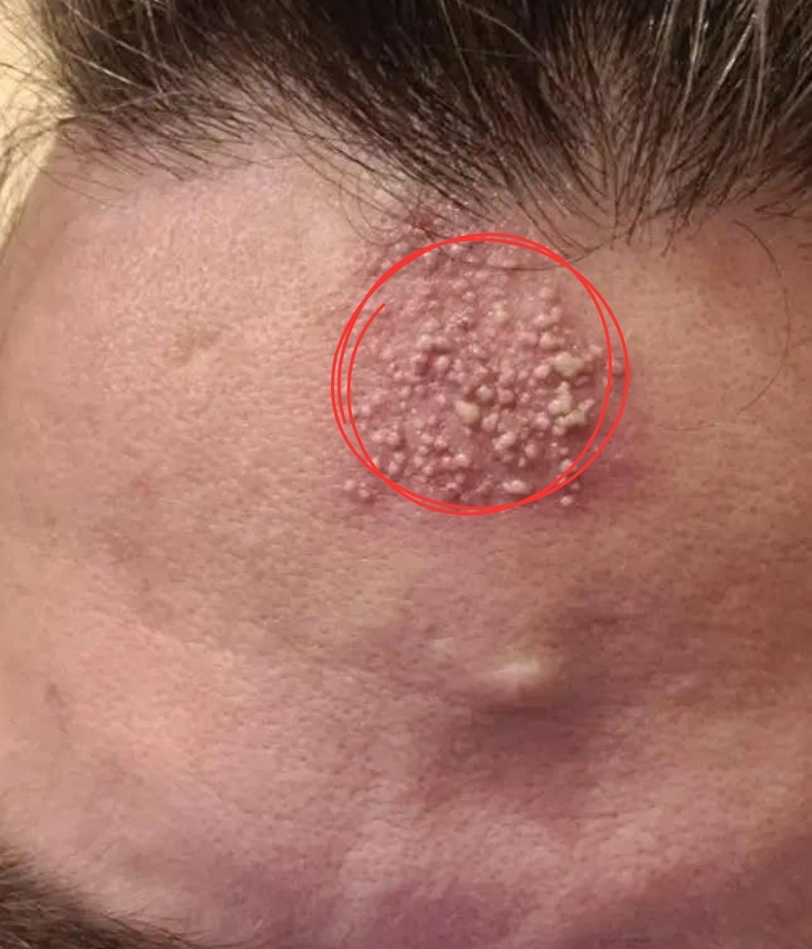 The Invisible Nightly Sabotage Why Your Lazy Bedtime Habit Is Secretly Destroying Your Skin And Risking Your Vision For Good